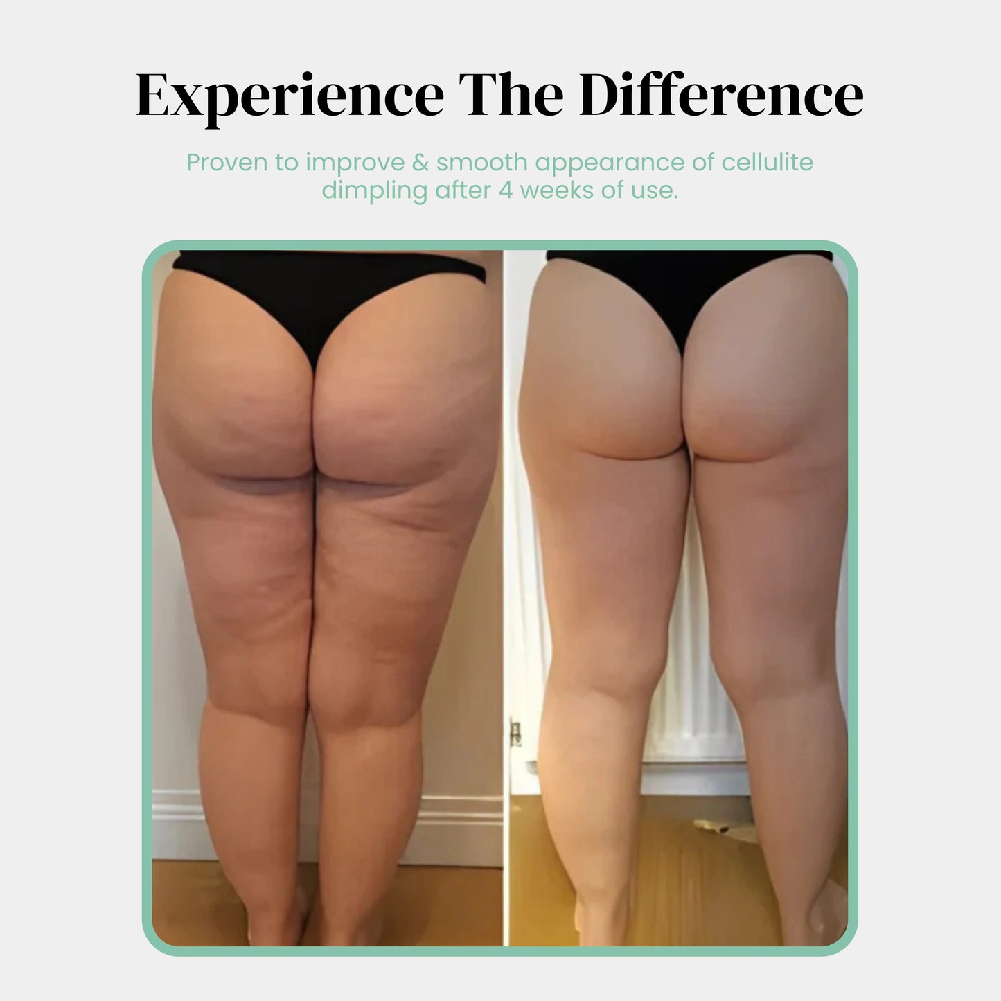 Noko Pro Cellulite Roller